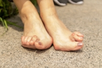 How Rheumatoid Arthritis Can Impact Feet